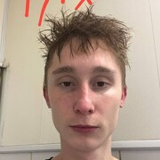 ���������� �������, ������ Scandal, 19