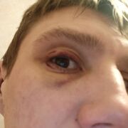 ���������� ������, ���� ������� Denis, 36 ���, ������������ ��� ������, ����� � ���������