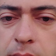  Zabkowice Slaskie,  Zura, 37