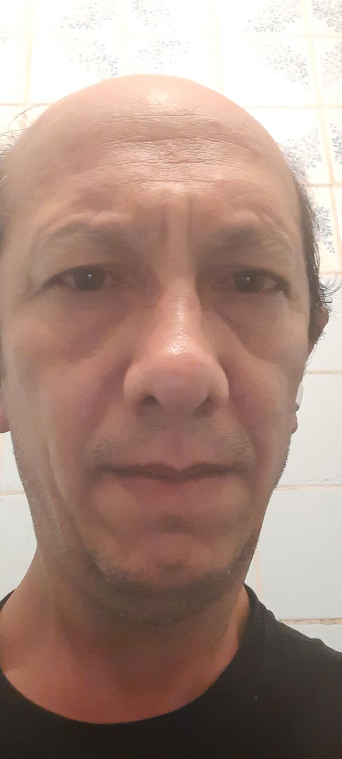  45599052  , 47 ,    