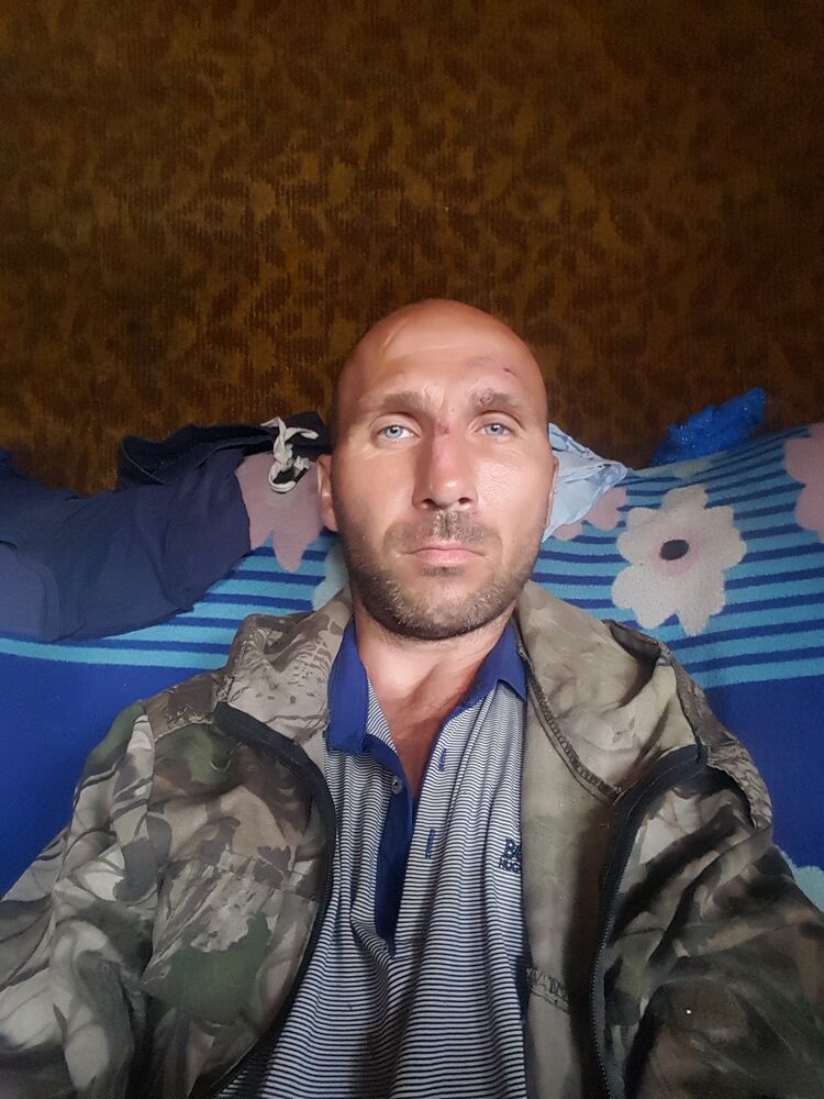  28362162  , 45 ,    