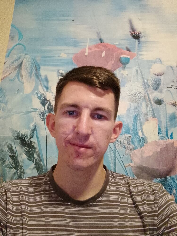  37843532  , 24 ,    