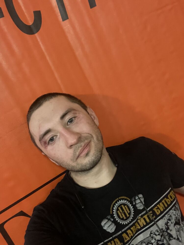  53577962  , 33 ,    --