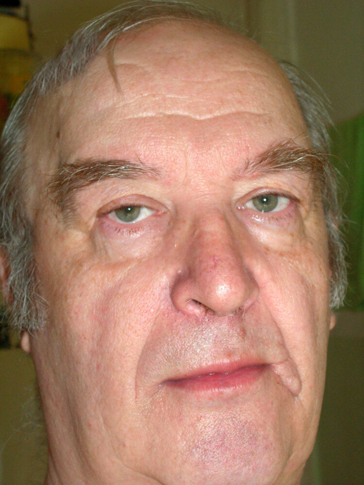 ���� 56471382 ������� ���������, 65 ���, ���� ���������� � ������������