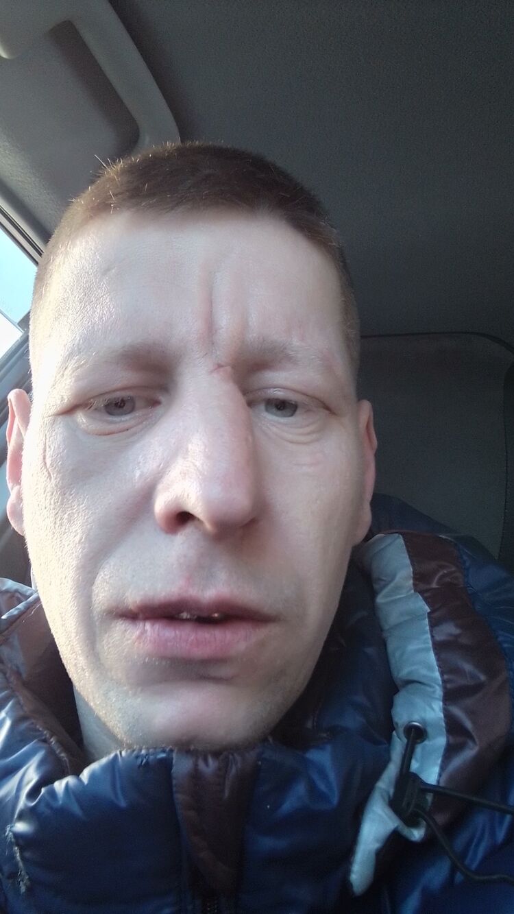  33659532  , 36 ,    