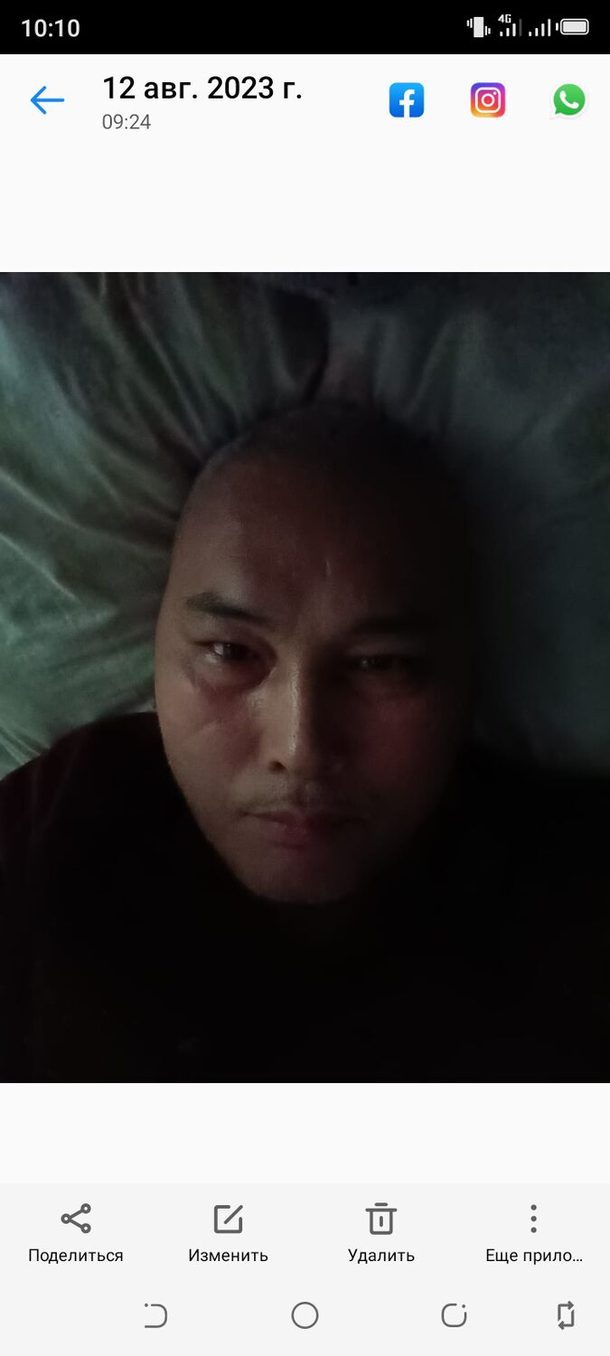  36934782  , 56 ,    