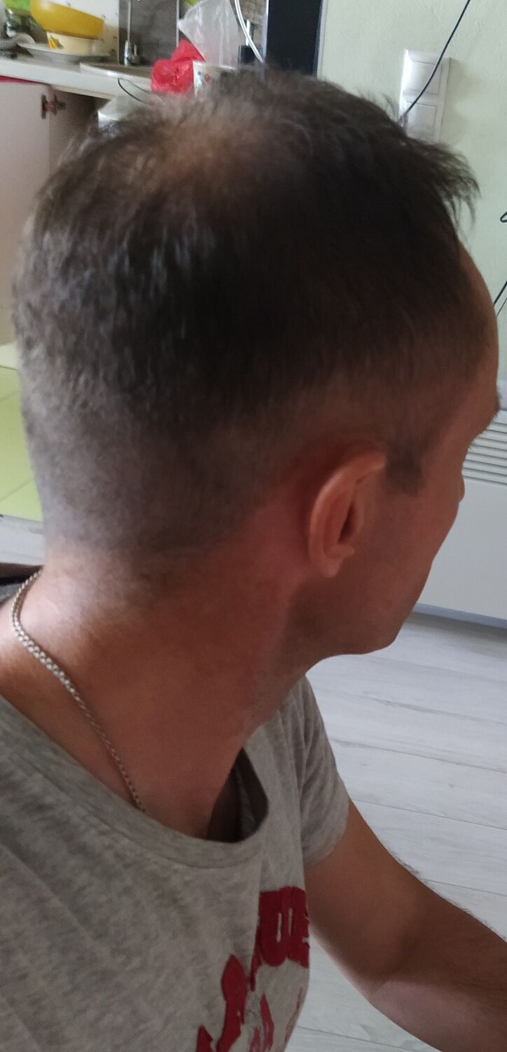  37237712  Nikolai, 45 ,    