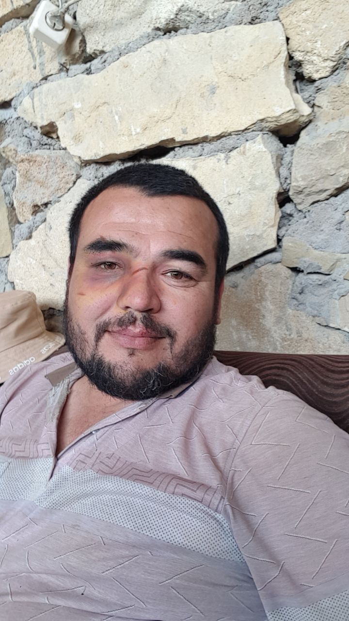  43589932  , 41 ,    