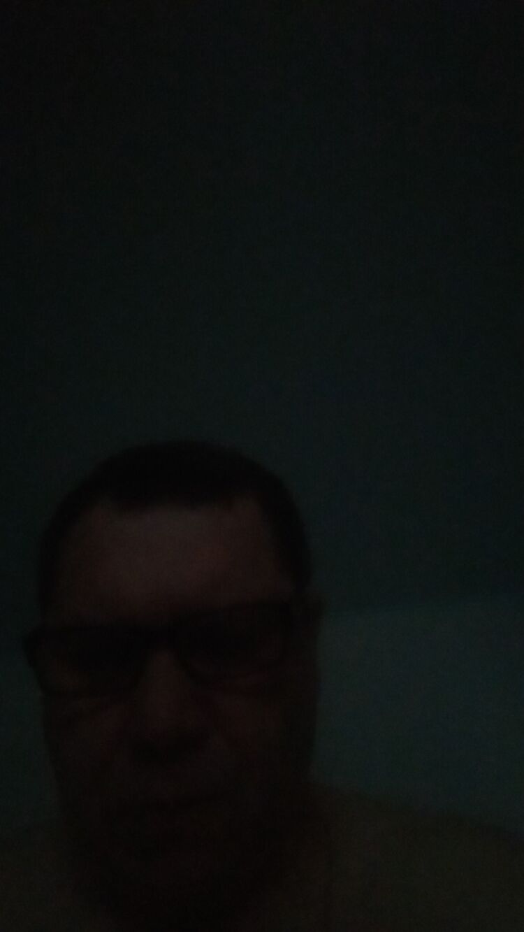  33644472  , 49 ,    