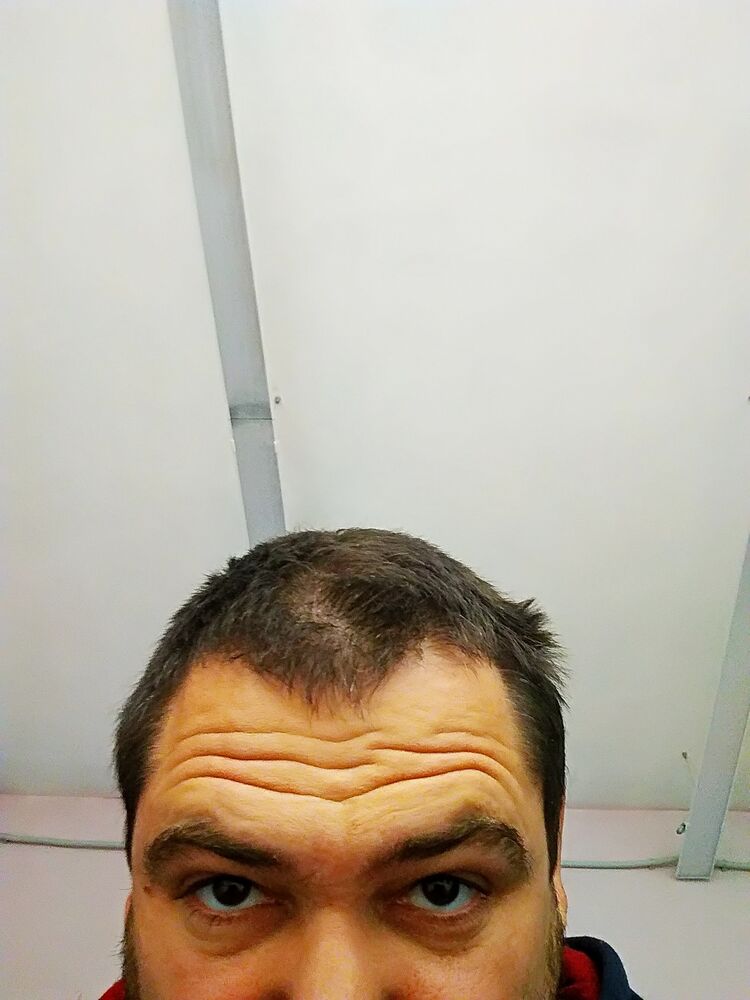  24028482  , 37 ,    
