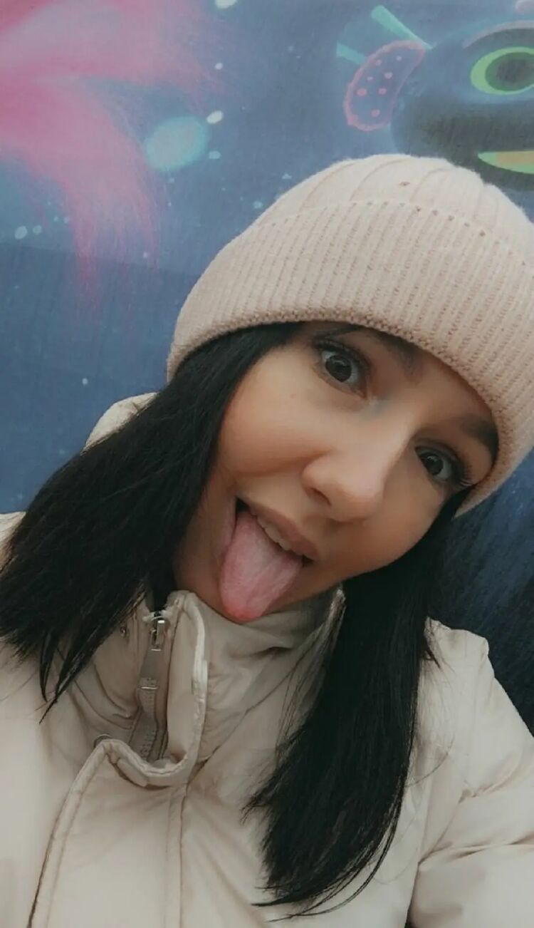  28887892  , 33 ,    