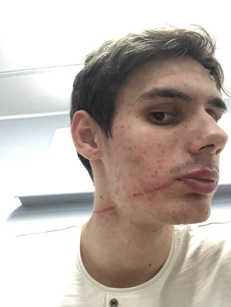 ���� 46666702 ������� ������, 35 ���, ���� ���������� � �����������