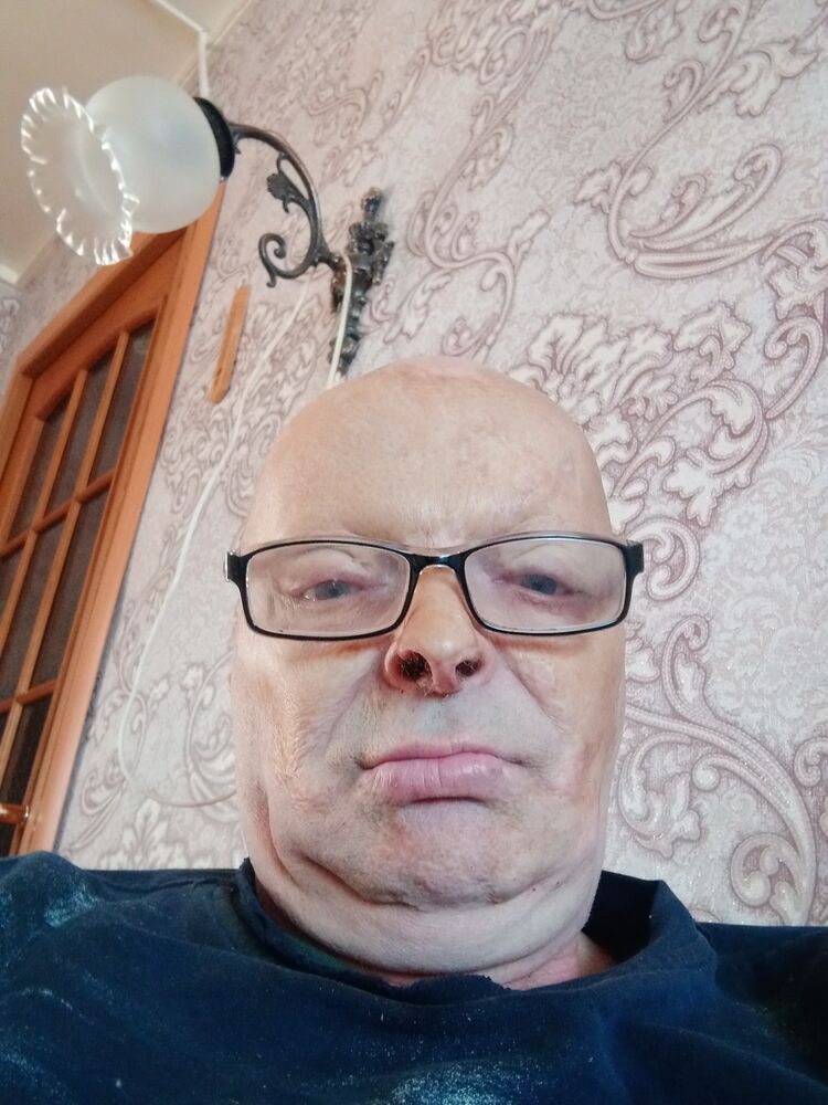  27667462  , 63 ,    