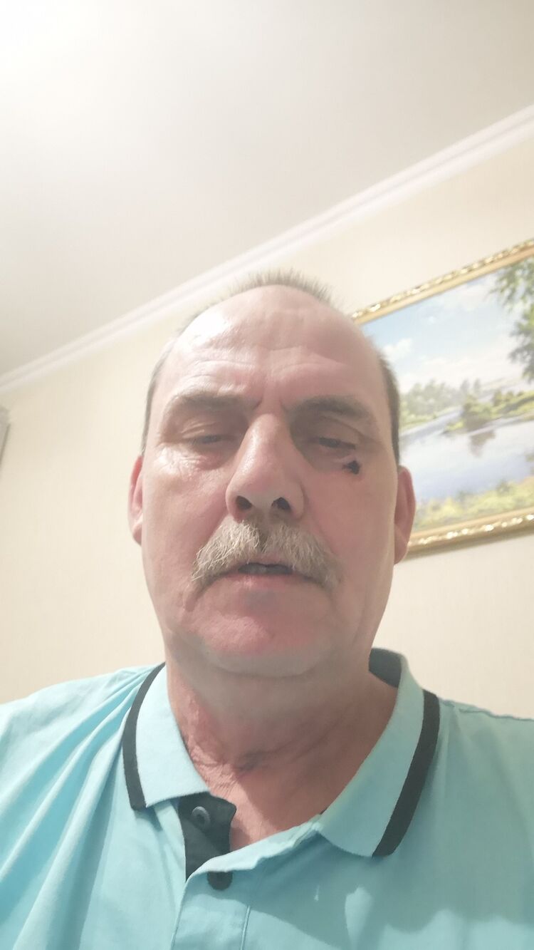 ���� 28911682 ������� ������, 65 ���, ���� ���������� � ������