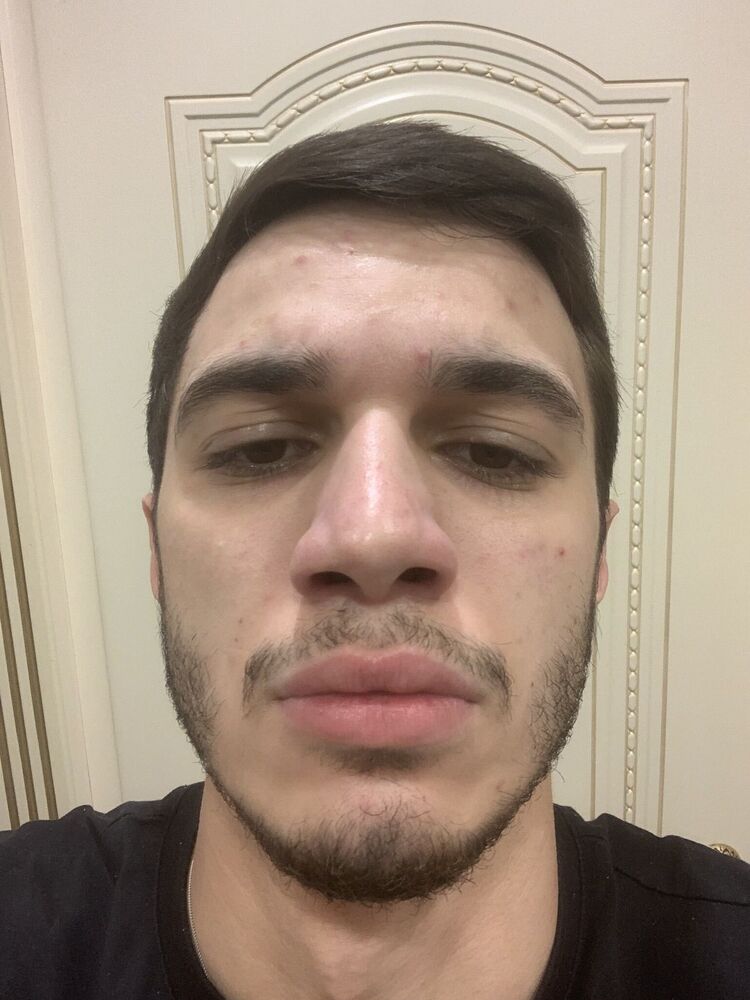 ���� 51880572 ����� �������, 24 ����, ���� ���������� � ������