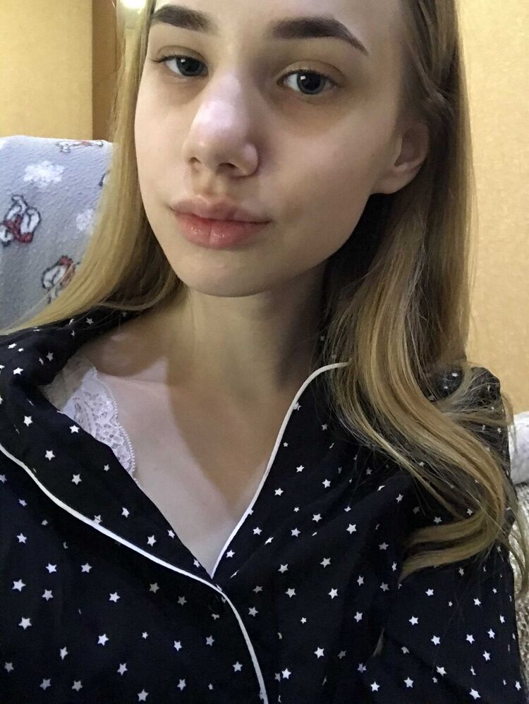  22006662  PolinA, 23 ,    