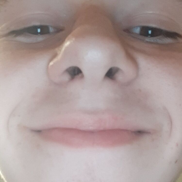  29507592  , 21 ,    