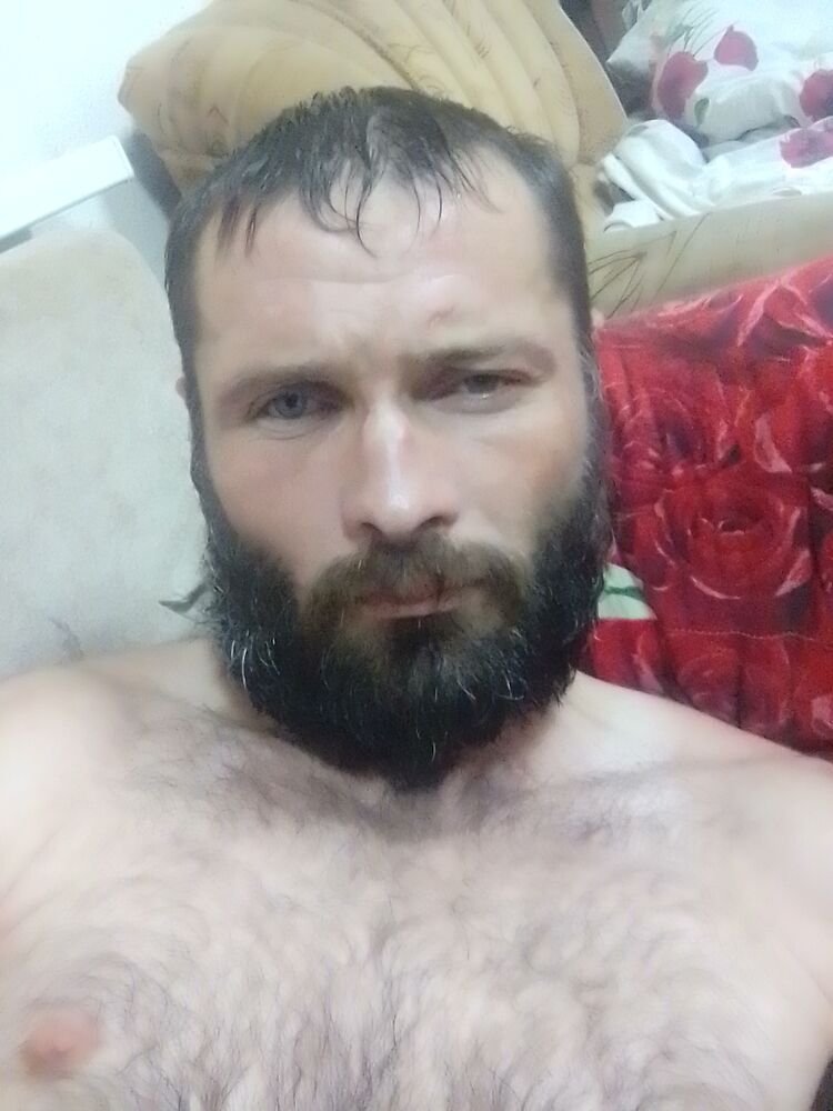  35412992   , 37 ,    