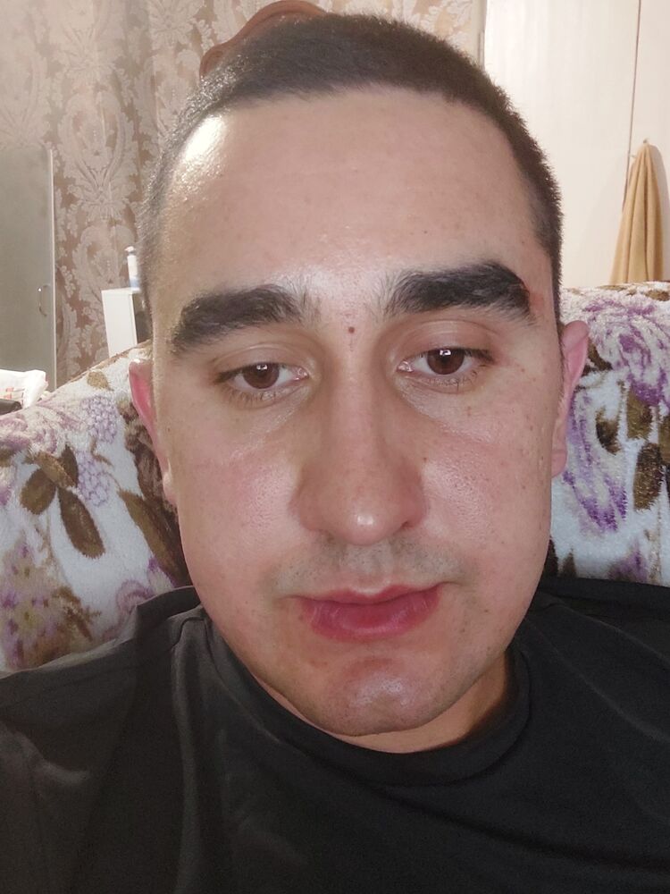  31727742  , 33 ,    