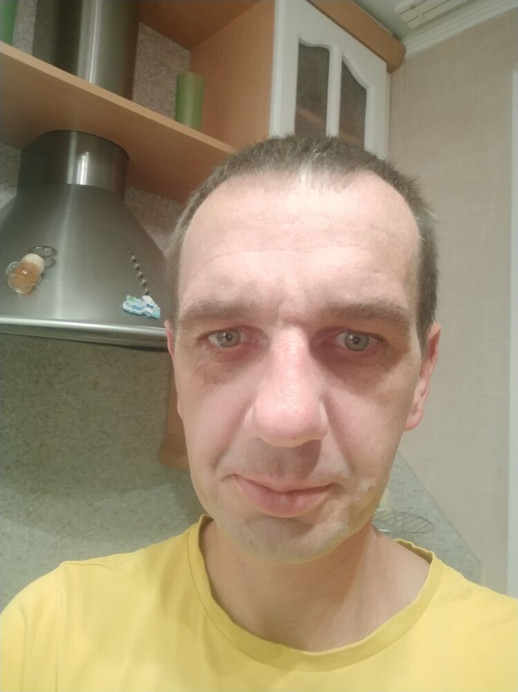  36668402  , 40 ,    