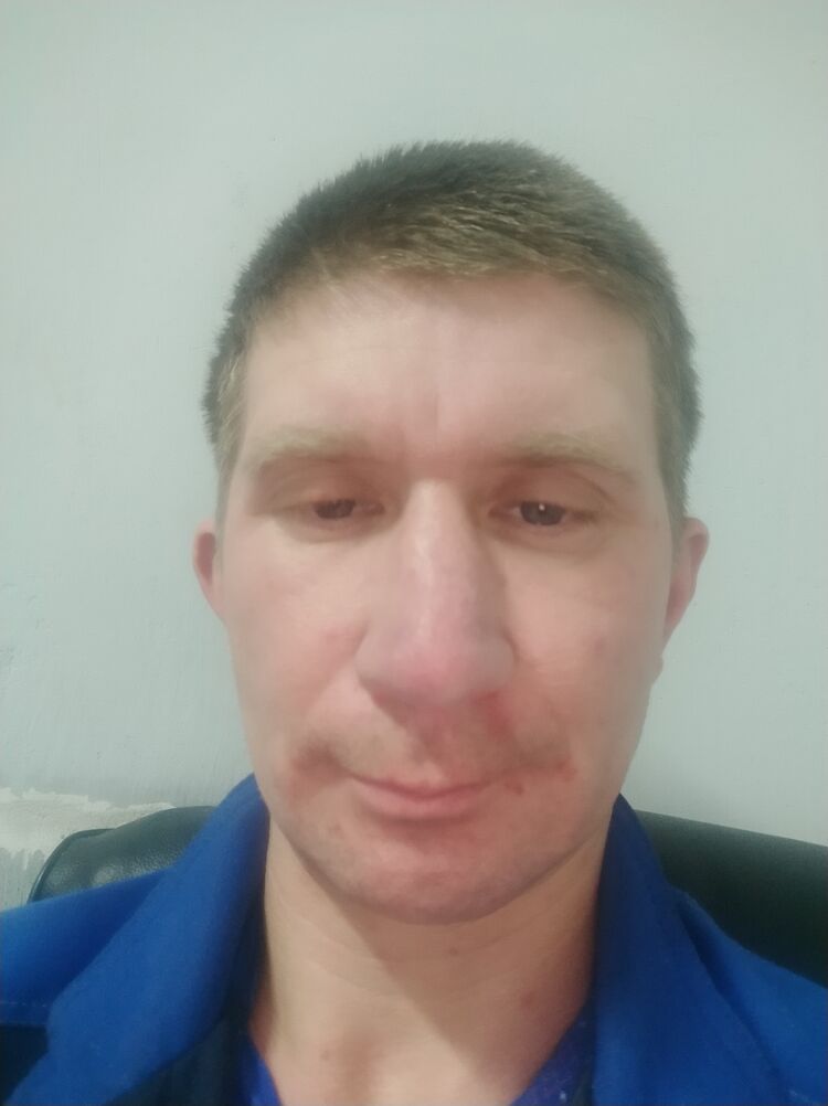  31998742  Anton, 43 ,    