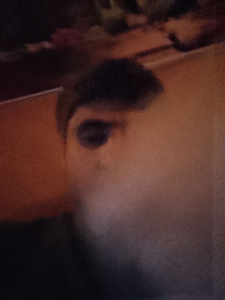  52238612  , 29 ,    --