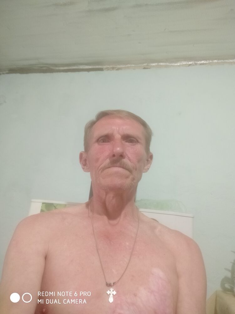  29748842  , 54 ,    