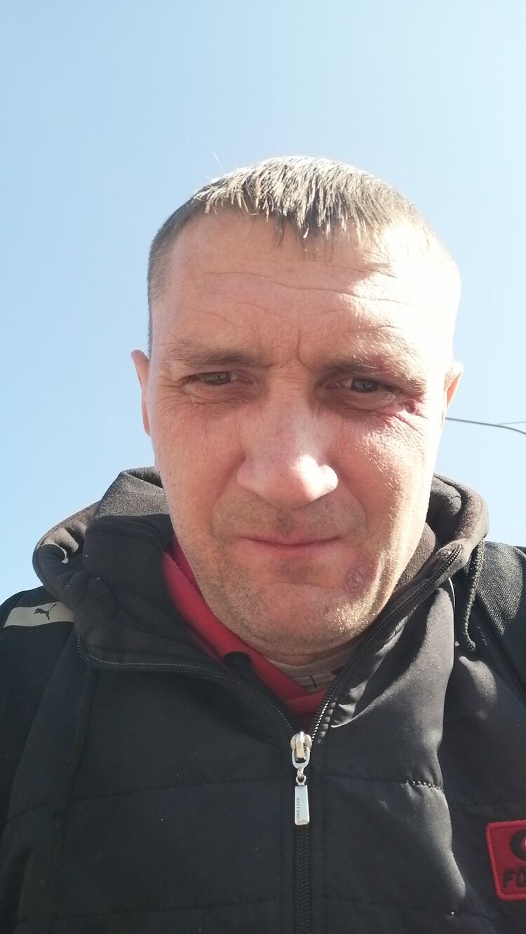  38249642  , 45 ,    