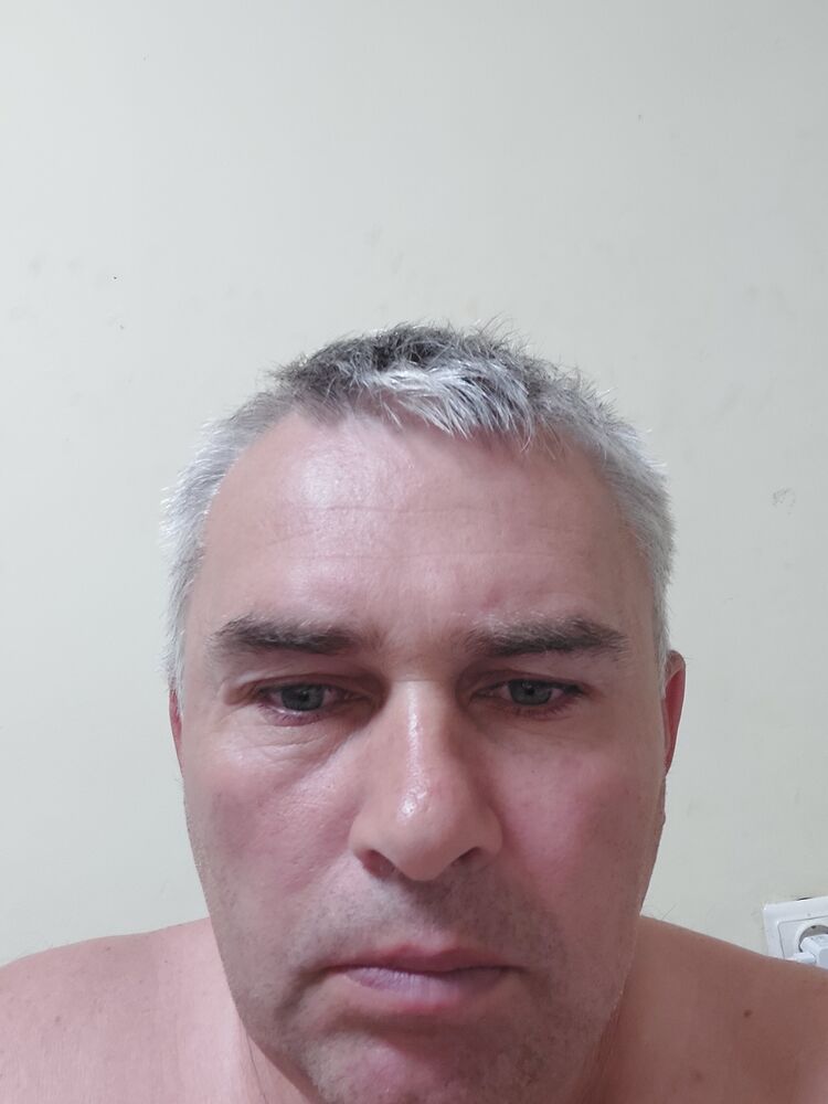  35612462  , 51 ,     