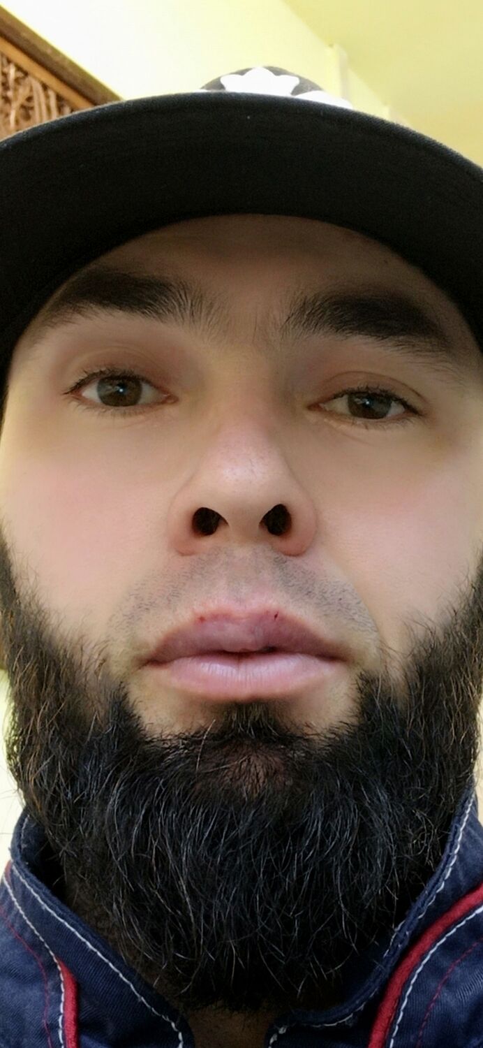  30034642  , 38 ,    