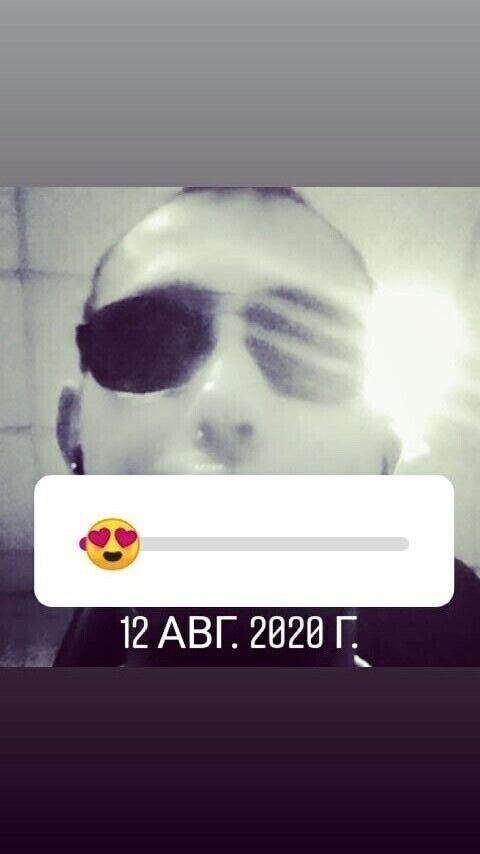  21149912  , 35 ,    