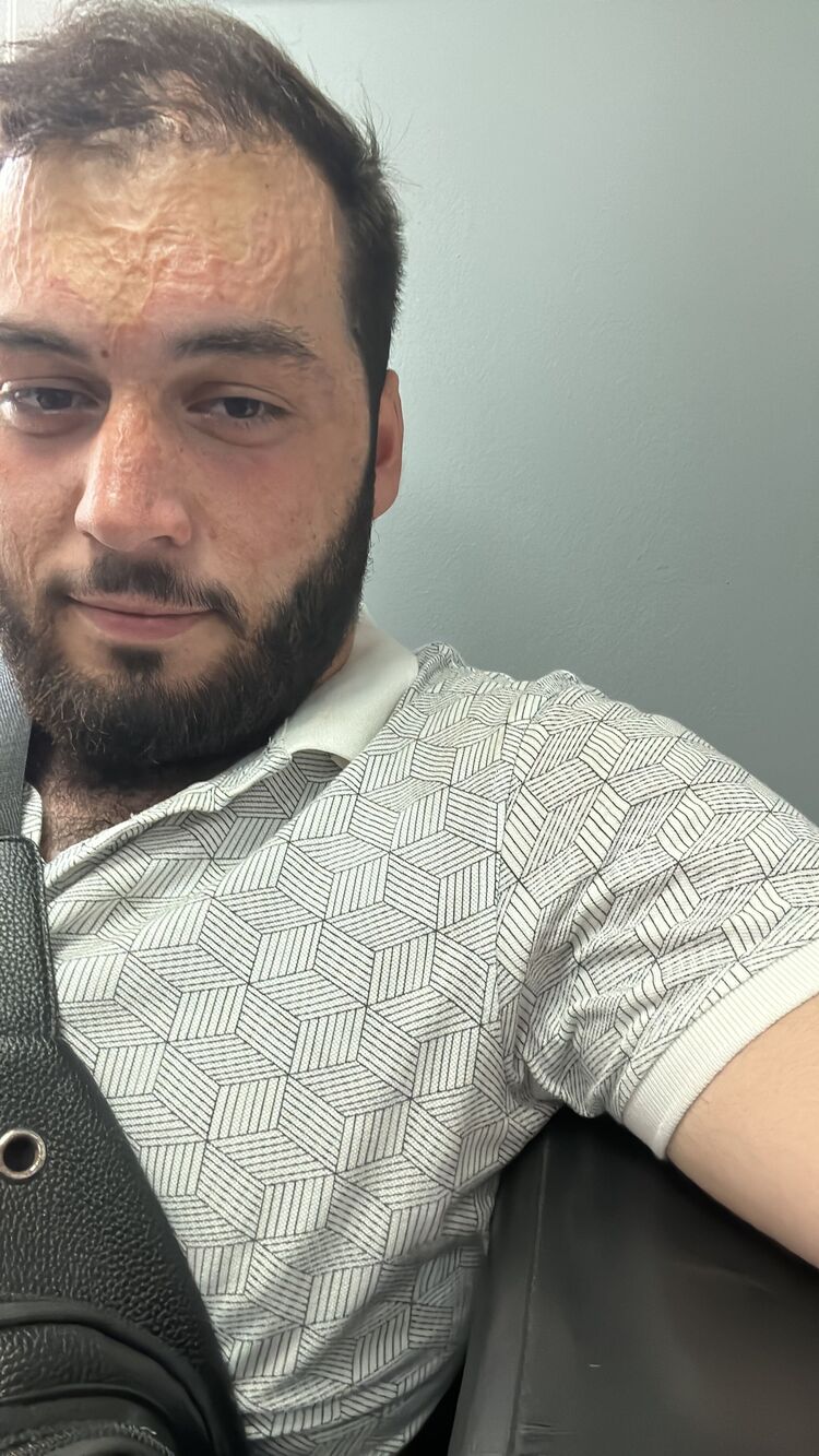  37599342  , 24 ,    