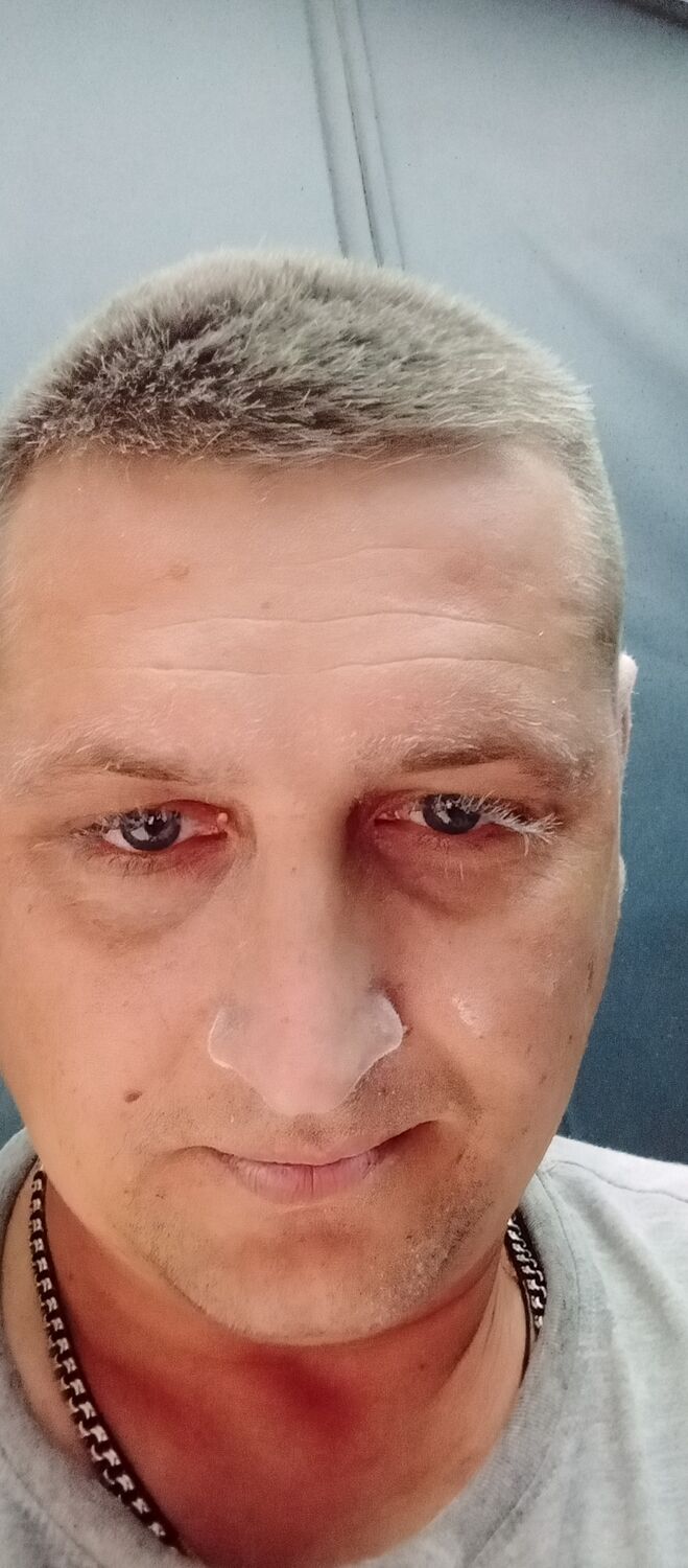  54021232  , 33 ,    Deleted